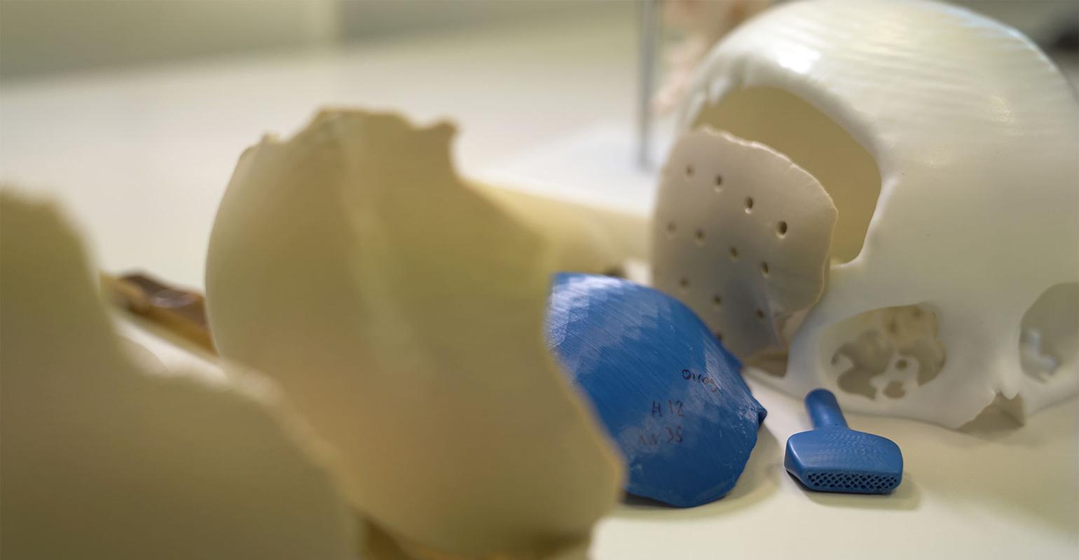 Produits médicaux imprimés en 3D