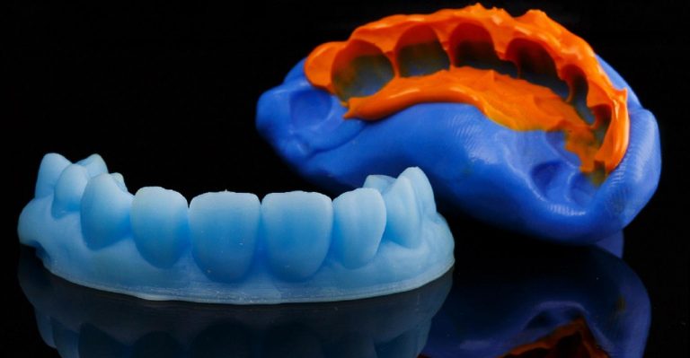Mon dentiste adore l’impression 3D, c’est rapide, précis et bon marché